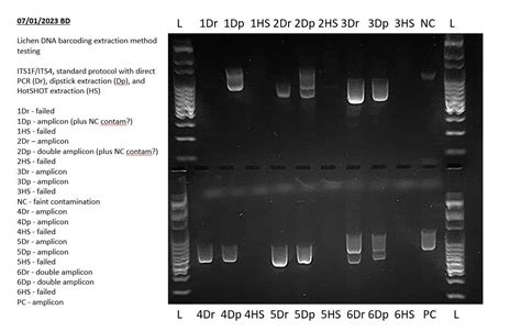 interpretation of dna gel electrophoresis results|Interpreting Electrophoresis Gels with Bento Lab.